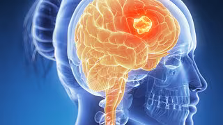 Gibt es bald mRNA-Therapien direkt fürs Gehirn?
