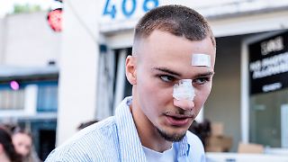 Kölner Stürmer Lemperle spricht über Prügel-Eklat