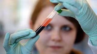 Immer mehr Schwangere in Mitteldeutschland nutzen Trisomie-Bluttest