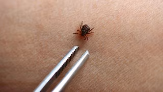 Gibt es in diesem Jahr besonders viele Zecken?