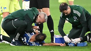 Blut und Gehirnerschütterung: Wirbel um Schalke-Held Katic