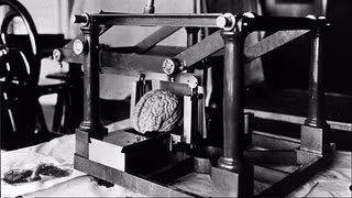 Gehirne und Augen für die Nazi-Forschung