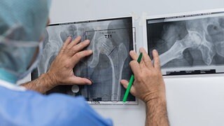 Patientenvertreter werfen Sana-Chef Altersdiskriminierung vor