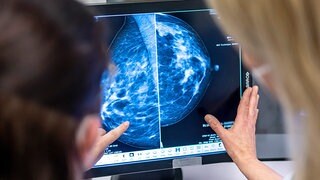 Mitteldeutsche Frauen nehmen Mammographie-Screenings gut an