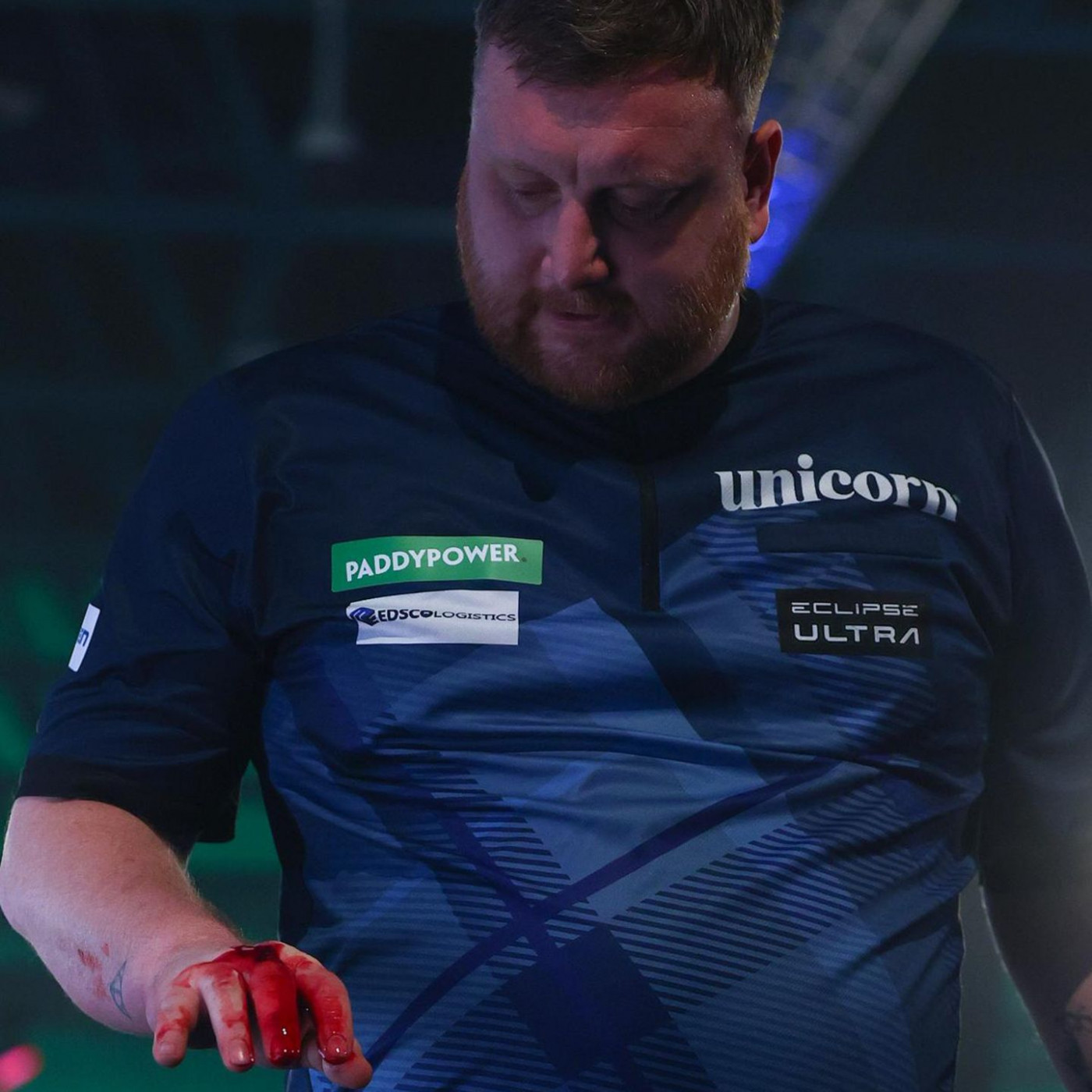 Blutige Hand nach Eklat: Darts-Profi erkl&auml;rt Ausraster