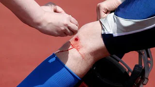 J&auml;hrlich Zehntausende Tote &ndash; Gro&szlig;projekt soll Sepsis-Versorgung verbessern