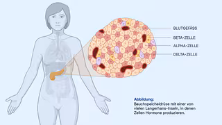 K&uuml;nstliche Intelligenz erkennt Typ-2-Diabetes im Gewebe der Bauchspeicheldr&uuml;se